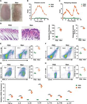 Estrogen Acts Through Estrogen Receptor-β to Promote Mannan-Induced Psoriasis-Like Skin Inflammation